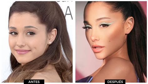 ariana grande eye problems.